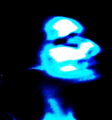 Autoportrait radiographique